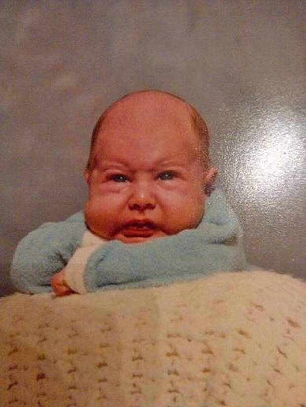 WorstBabyPhotos13 Эти ужасные младенцы