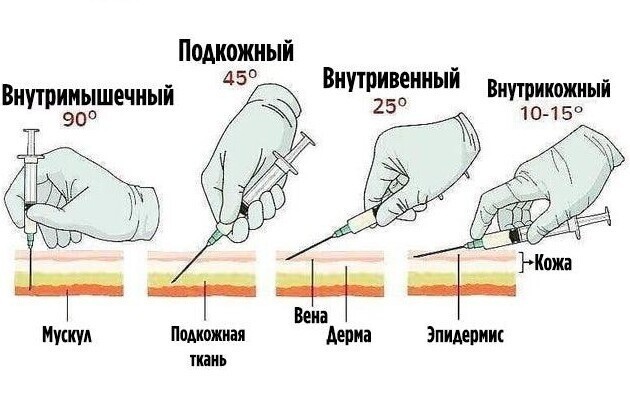 Как делать инъекции