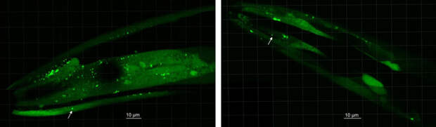 Рис. 5. Светящиеся отложения амилоида в головном конце нематоды — что-то вроде «телец Леви» у червя