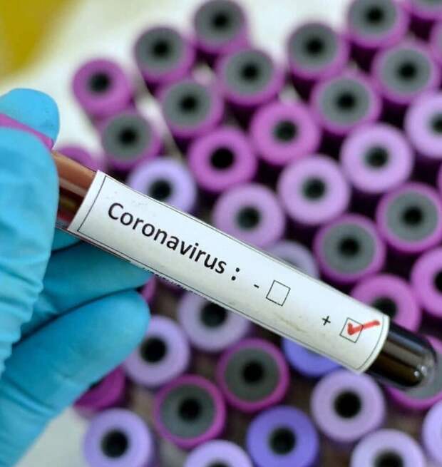Действия врачей при подозрении на коронавирусную инфекцию. Какие инструкции дало руководство нашей поликлиники