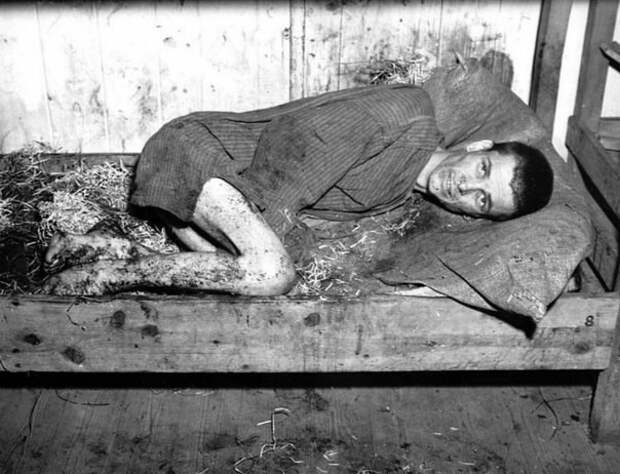 Истощенный больной узник  интересно, история, фото