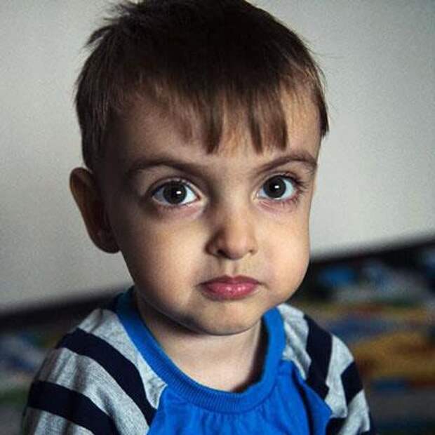 Артем Булатников, 3 года, хроническая почечная недостаточность в терминальной стадии, спасет трансплантация почки, необходимы лекарства, 91 411 ₽