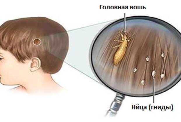 Врачи не расскажут Вам об этом!