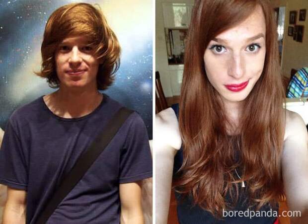 22-Year-Old Male To Female, 4 Months On HRT