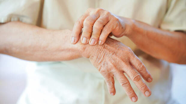 Остеопороз: как распознать до первого перелома