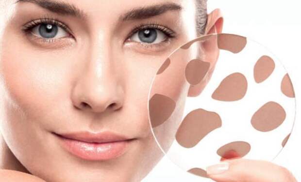 8 сигналов кожи лица о том, что в вашем организме присутствуют неполадки