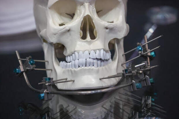 Какие простые продукты неожиданно защитят зубы от кариеса?