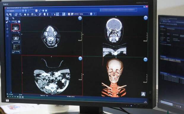 Врача больницы на улице Вучетича признали лучшим рентгенологом Москвы
