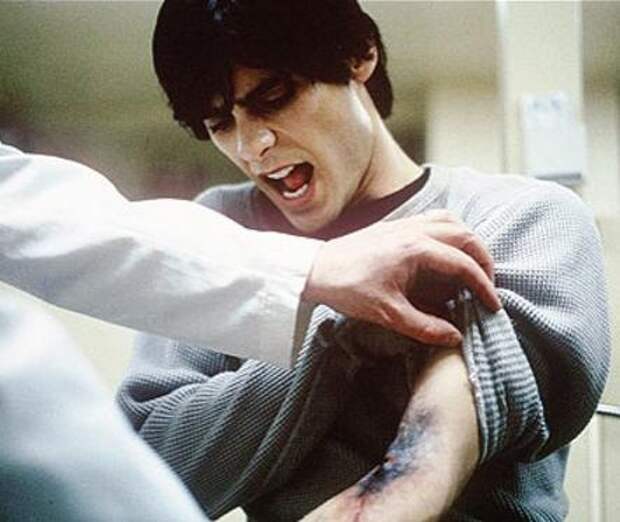 <B>Реквием по мечте (2000)</B><BR> После того, как воспаление Гарольда (Джаред Лето) на руке, в вену которой он вводил наркотики, переходит в гангрену, из-за отсутствия лечения в больнице и тюрьме ему ампутируют руку. Самые культовые сцены мирового кинематографа