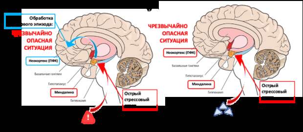 Механизм формирования ПТСР: гиперсенсибилизация к опасности. 