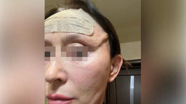 Последствия операции / Фото: предоставлено героиней материала 