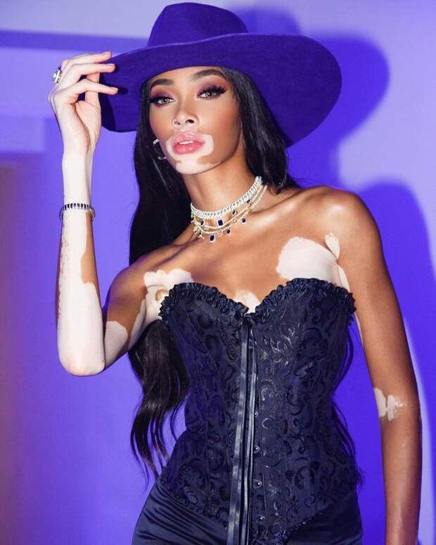 instagram.com/winnieharlow/
