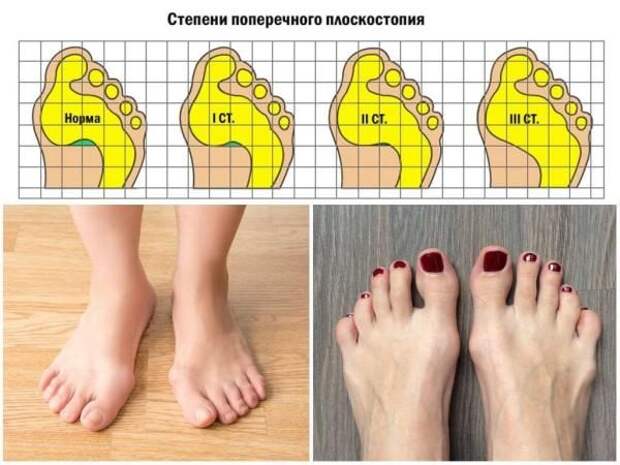 5 причин не покупать дешевую обувь