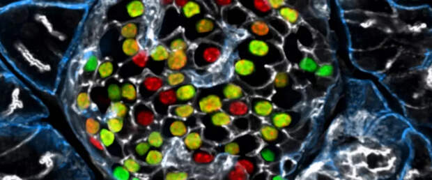 Ученые представили новую стратегию лечения диабета