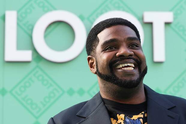 Популярный актер раскрыл причину облысения после пересадки волос