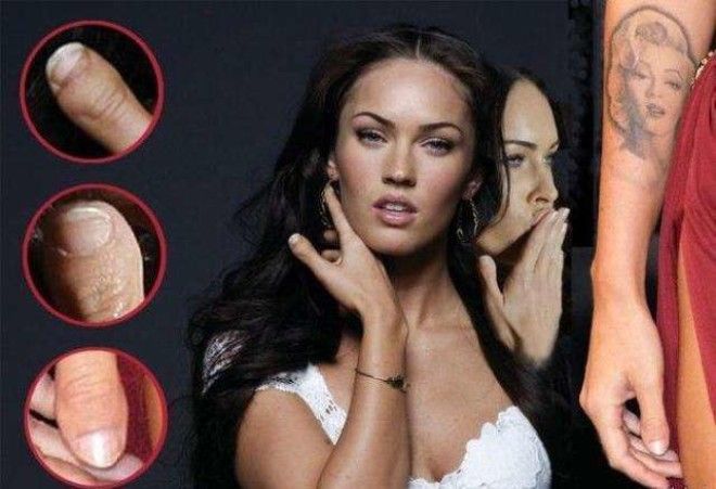 ⭐ 9 знаменитостей с дефектами, которые ты не замечал