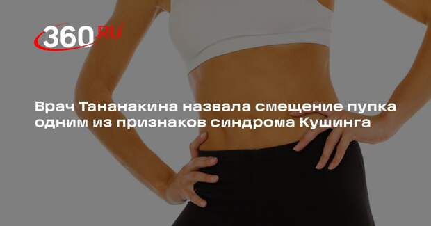 Врач Тананакина назвала смещение пупка одним из признаков синдрома Кушинга