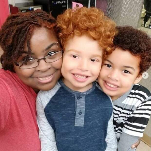 У афроамериканской семьи родился светлокожий сын с рыжими волосами – это стало потрясением для всех