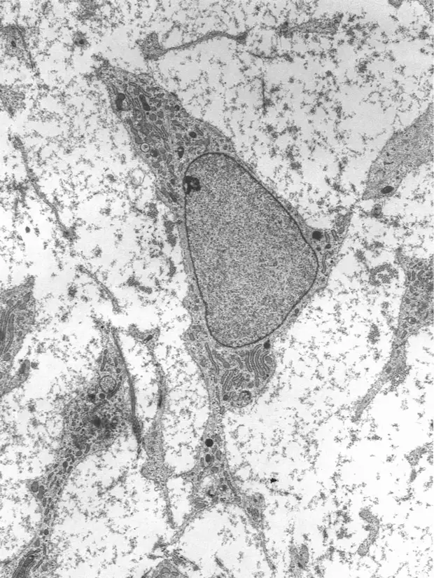 Просвечивающая электронная микрофотография мезенхимальной стволовой клетки, показывающая типичные ультраструктурные характеристики