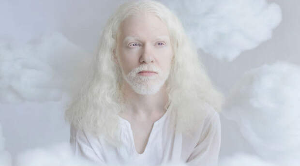 Гипнотическая красота альбиносов в фотопроекте Юлии Тайц
