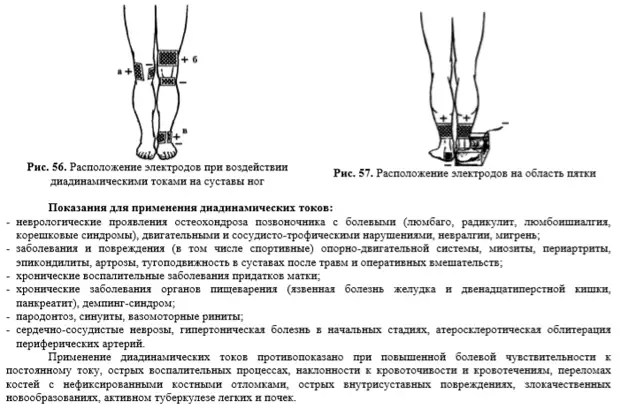 Электрофорез крестцового отдела. Методика проведения электрофореза. Схема расположения электродов при электрофорезе. Электрофорез стопы методика. Методики электрофореза в физиотерапии.