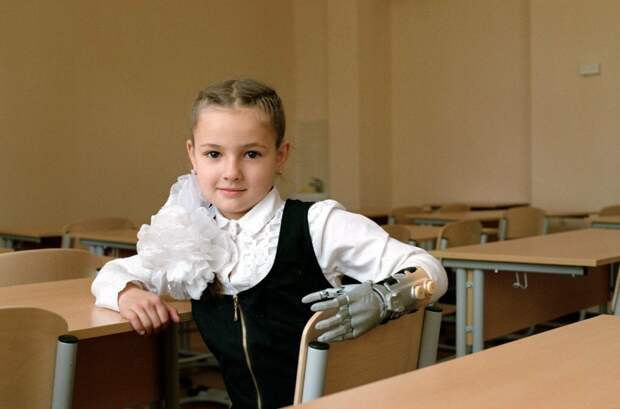 А это девочка, которая ходит в обычную школу с протезом руки (фото с сайта The-Village.ru)