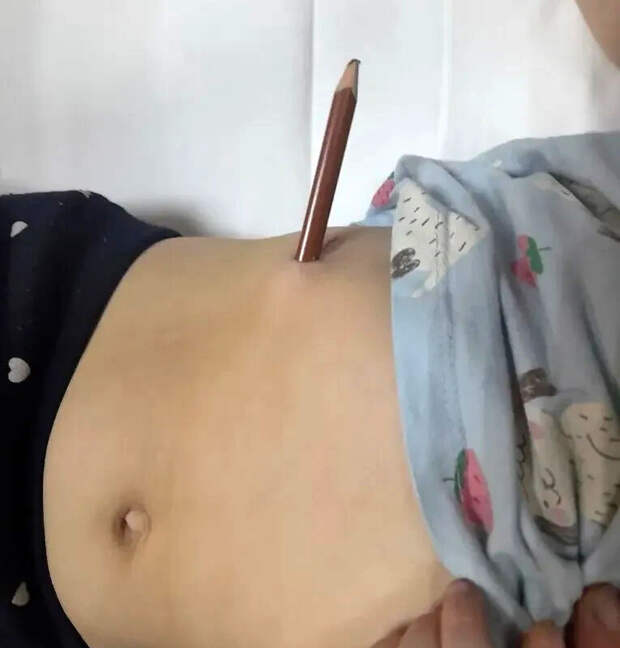 В Башкирии ребенок упал на карандаш и проткнул себе живот