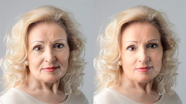 Кожа лица до и после омолаживающих процедур