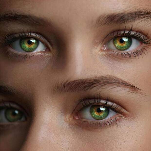 Жёлтые бляшки на веке – признак повышенного холестерина