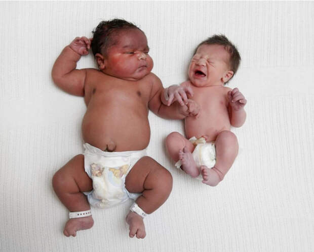 В Австралии женщина родила ребенка в два раза крупнее обычных малышей