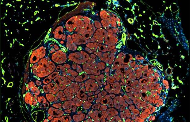 Эта картинка показывает искусственную «мини-печень»:клетки (оранжевый цвет) перестраиваются и растут после повреждения, используя для роста кровь.