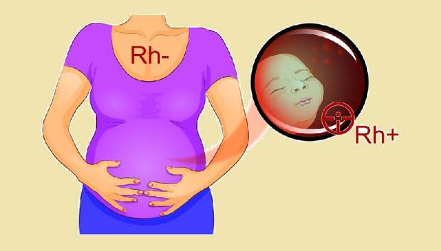 Отличительные черты людей с отрицательным резус-фактором