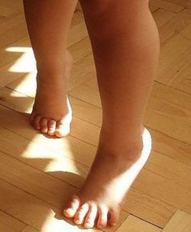 Почему человек ходит на носочках. Ноги на носочках. Ребёнок ходит на насоч. Ребенок ходит на носочках.