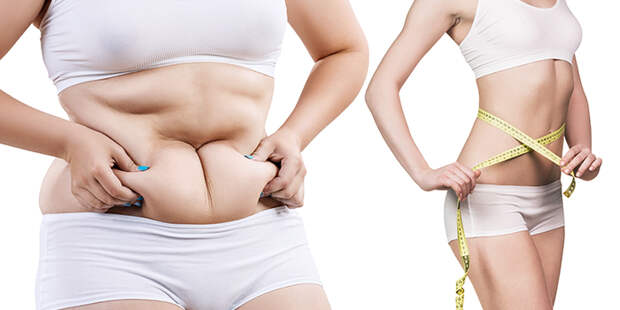 Локальные жировые отложения: причины возникновения и методы коррекции