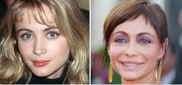 Слева: Эммануэль Беар до пластики. Справа: актриса в 2010 году, в 47 лет. Фото: GLOBAL LOOK PRESS