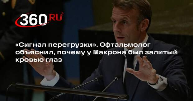Офтальмолог Шилова: покраснение глаза Макрона связано с кровоизлиянием