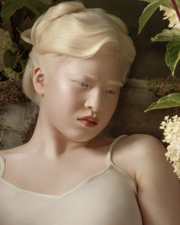 Meet-Chinese-Xueli-Abbing-the-albino-abandoned-when-she-was-a-baby-who-became-a-Vogue-model-6090f7923c9d4__700 (1).jpg