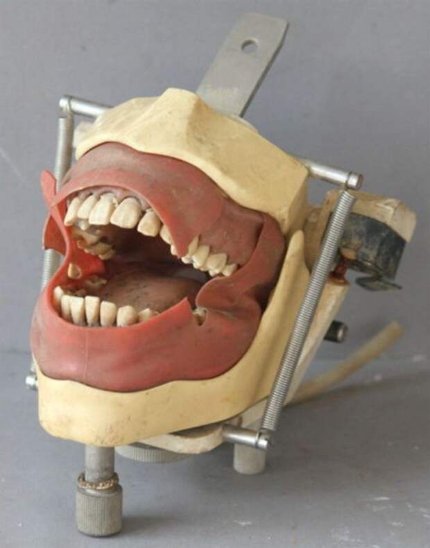 Жуткие стоматологические инструменты прошлых лет (20 фото)