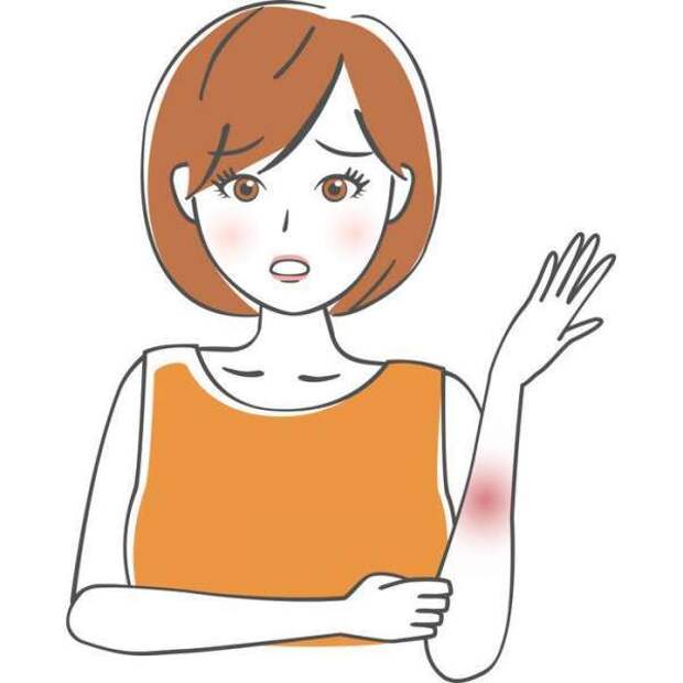 Как быстро убрать синяк на теле