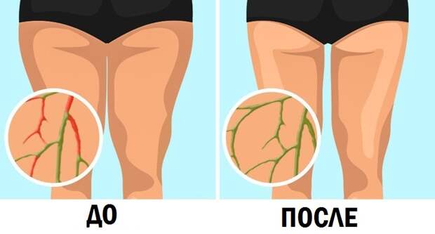 6 упражнений для лимфодренажа: они помогут похудеть без диеты и улучшить состояние кожи