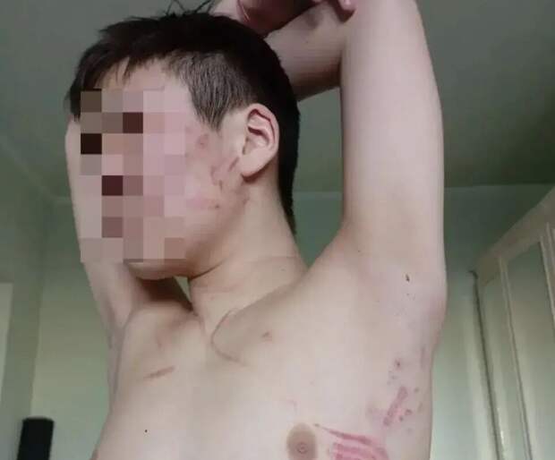 В Тыве мальчик обвинил мать в истязании