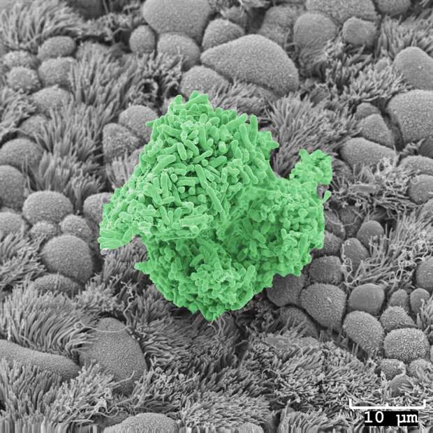 Синегнойные палочки, образовавшие биопленку на клетках трахеи мыши / © The University of Iowa — Central Microscopy Research Facility
