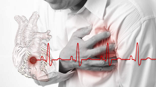 Что делать при сердечном приступе? Первая помощь