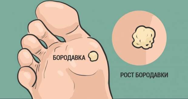 thumb-600x315 (1)