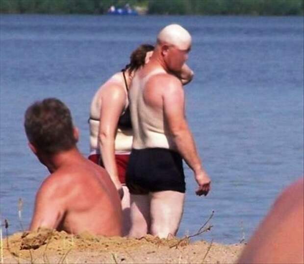 Самый смешной и неудачный летний загар
