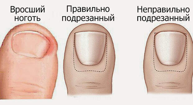 Картинки по запросу Золотые правила безупречного педикюра