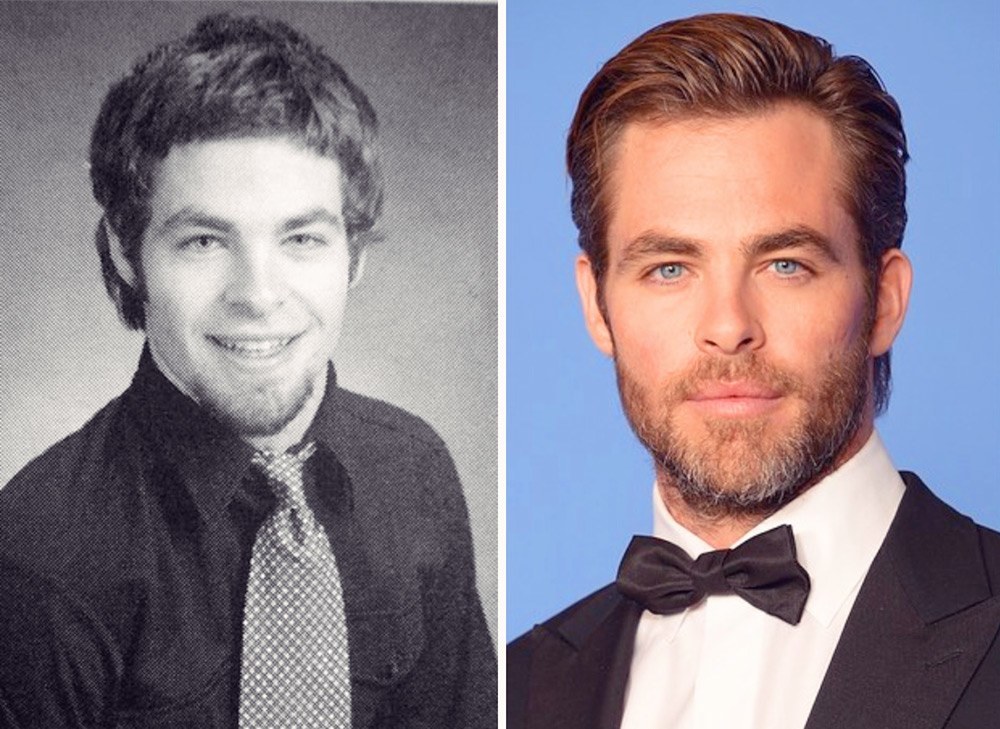 FormerlyAwkwardCelebs15 Вечно недовольны собственной внешностью? Всего 20 фото докажут, что надежда есть!