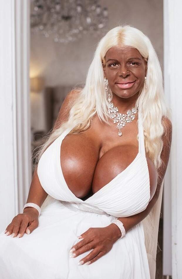 Жительница Германии решила стать афроамериканкой. Вот как она выглядит теперь! Мартин Биг, в мире, внешность, красота, люди, операция