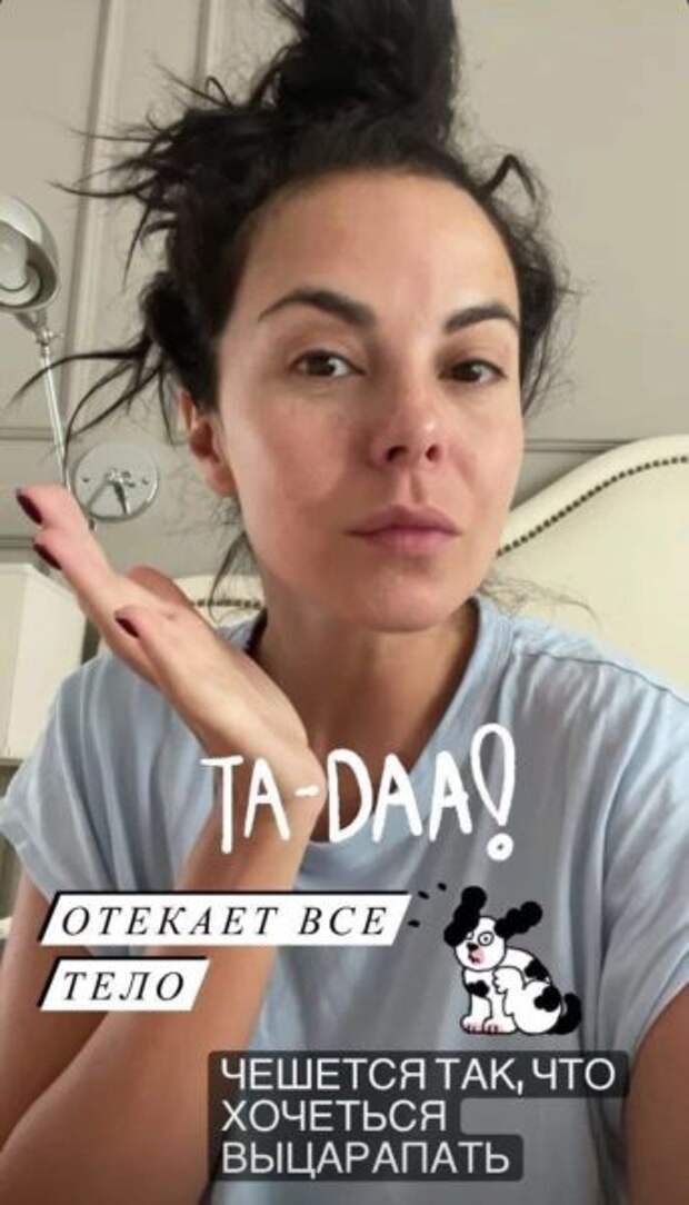 Настя Каменских страдает от аллергии на амброзию