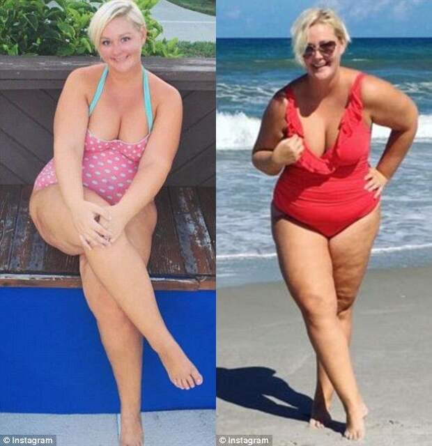 Своей фотографией эта женщина доказала, что похудение это не всегда путь к счастью